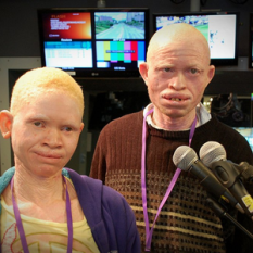 Tanzania Albinism Collective