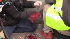 GRAPHIC: Protester has hand ripped off during Yellow Vest march in Paris