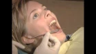 Mandibular Anesthesia - Gow-Gates Block