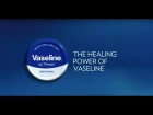 Vaseline Lip Therapy Tins Prove Their Healing Power
