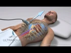 How to obtain: Inferior Vena Cava Ultrasound View- Training and Techniques - ICU